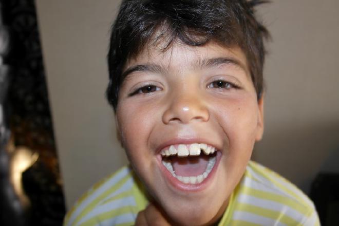 Hugo - 10 anos